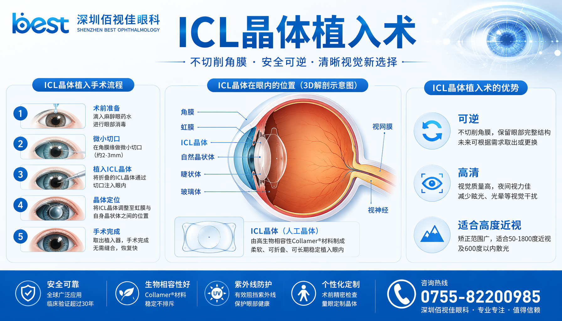 龙岩市 深圳佰视佳眼科ICL晶体植入术适合高度近视